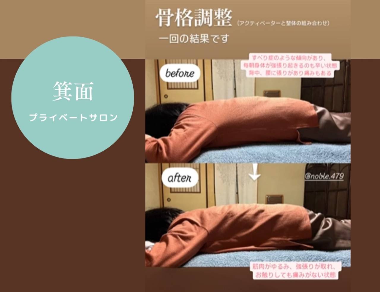 【箕面市エステはnoble】背中丸まってませんか?
